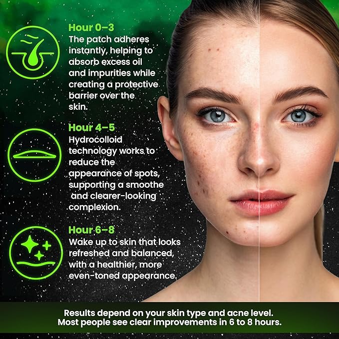 Andlane 280Pcs Star Pimple Patches for Face - Pimple Patches Cute Stars - Hydrocolloid, Salicylic Acid, Tea Tree Oil, Centella - Glow in the Dark, 3 Sizes Zit Stickers