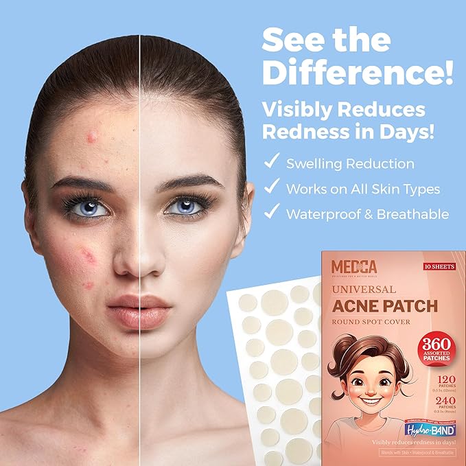 Acne Patches for Face - Hydrocolloid Bandages (360 Count) Pimple Patches for Face in 2 Universal Sizes, Acne Spot Treatment Care for Face & Skin Spot Patch Conceals Zits, Acne and Blackheads