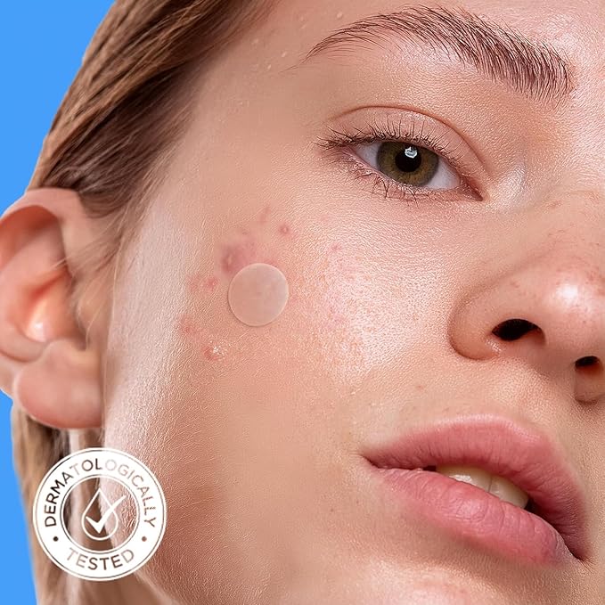 AVARELLE Pimple Patches for Face | Hydrocolloid Acne Patches for Covering Blemishes | Zit Patches with Tea Tree, Calendula, & Cica | HSA Store Eligible Items (10-14 mm, 200, Count)