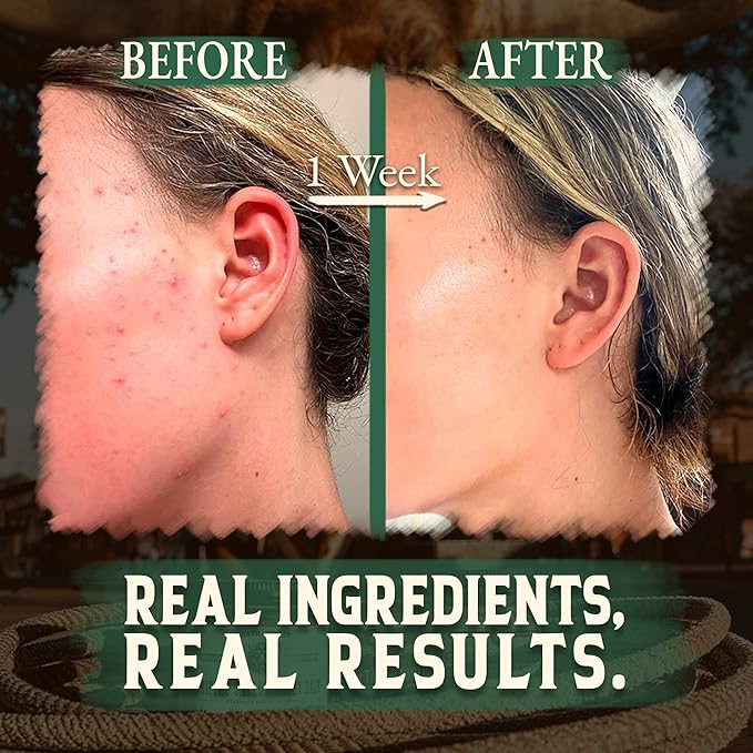 Wrath & Remedy Handmade Whipped Organic Beef Tallow for Skin - 4 OZ (Eucalyptus) — Grass Fed Beef Tallow Moisturizer and Honey Balm for Silky, Sensitive-Skin, Eczema, Rosacea - Free of Harsh Chemicals