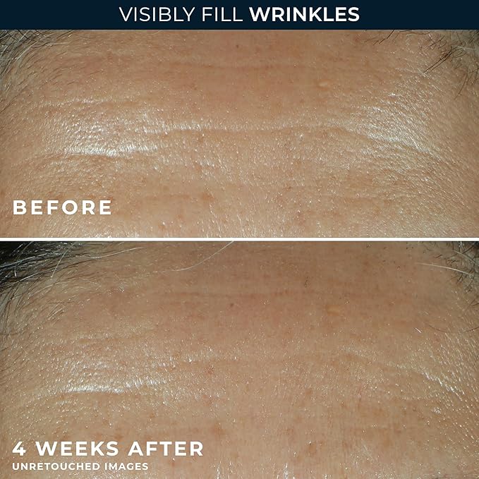 RoC Retinol Correxion Deep Wrinkle Facial Filler with Hyaluronic Acid & Retinol, Skin Care for Women and Men, 1 Fl Oz (Packaging May Vary)