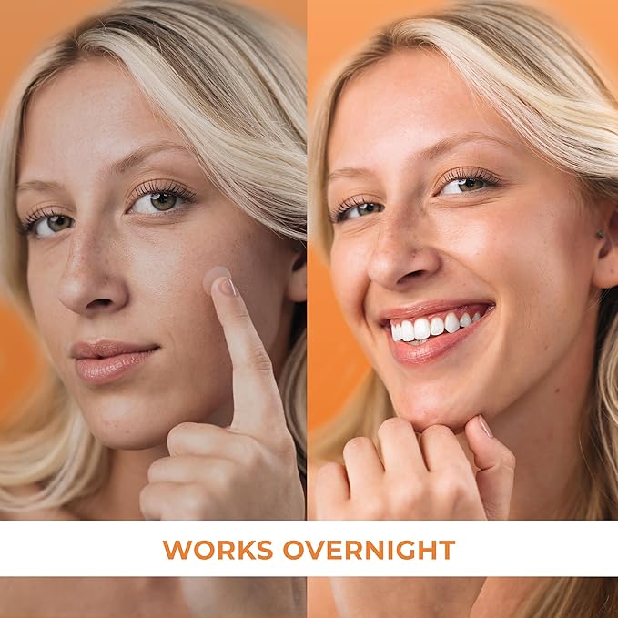 Pimple Patches for Face (240 Patches), Hydrocolloid Acne Patches, Pimple Patch Pimple Stickers, Hydrocolloid Patch Acne Dots Acne Pimple Patches For Face, Zit Patches, Acne Spot Treatment