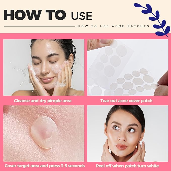 Rudraksh Pimple Patches for Face, 288 Counts, Hydrocolloid Pimple Patches, Invisible Patches for Face, Not Tested On Animals, 2 Multiple Sizes, Round Shape (288 Counts (2 Sizes))