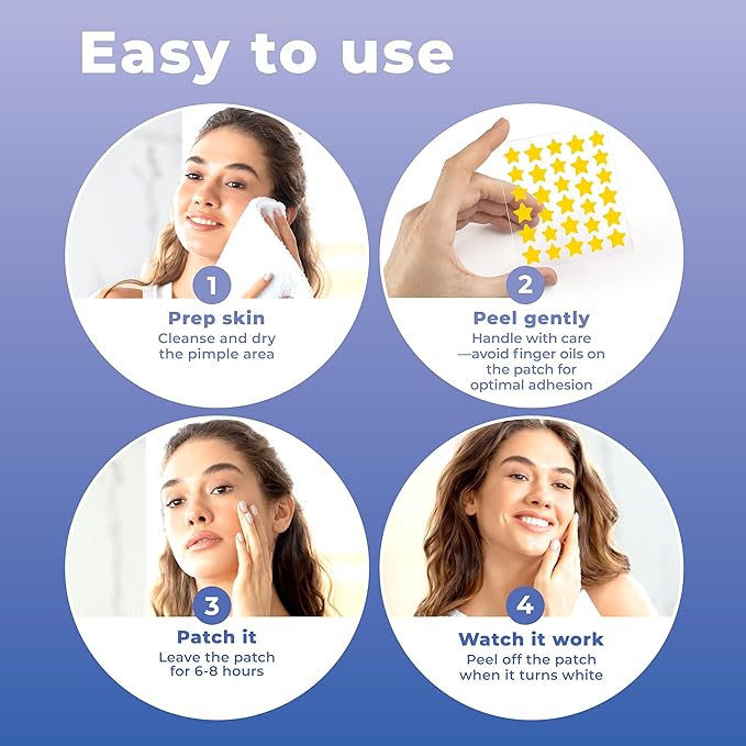 Star Pimple Patches for Face (240 Patches) with Hydrocolloid Only, Cute Acne Patches, Star Patches for Teens and Adults Zit Patches Stickers for Face, Fun Blemish Patches