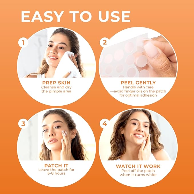 Pimple Patches for Face (240 Patches), Hydrocolloid Acne Patches, Pimple Patch Pimple Stickers, Hydrocolloid Patch Acne Dots Acne Pimple Patches For Face, Zit Patches, Acne Spot Treatment
