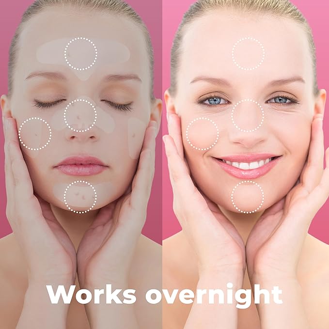 Full Face Pimple Patches (5 Sets), Reduce Pimples On Whole Face Overnight, Hydrocolloid Acne Mask, Pimple Patches, Large Acne Patches, Full Face Hydrocolloid Mask