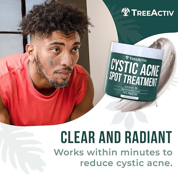 TreeActiv Cystic Acne Spot Treatment, Hormonal & Overnight Sulfur Cystic Treatment For Face, Pimples, and Blemishes for Adults, Men, and Women - 0.5oz 120+ Uses