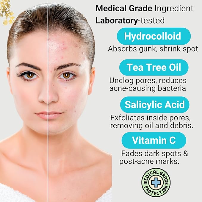 Acne Patch –Invisible Pimple Patches for Face & Body, Miracle Patch with Fast-Acting Hydrocolloid, Salicylic Acid & Tea Tree Oil – Waterproof & Hypoallergenic, 3 Sizes