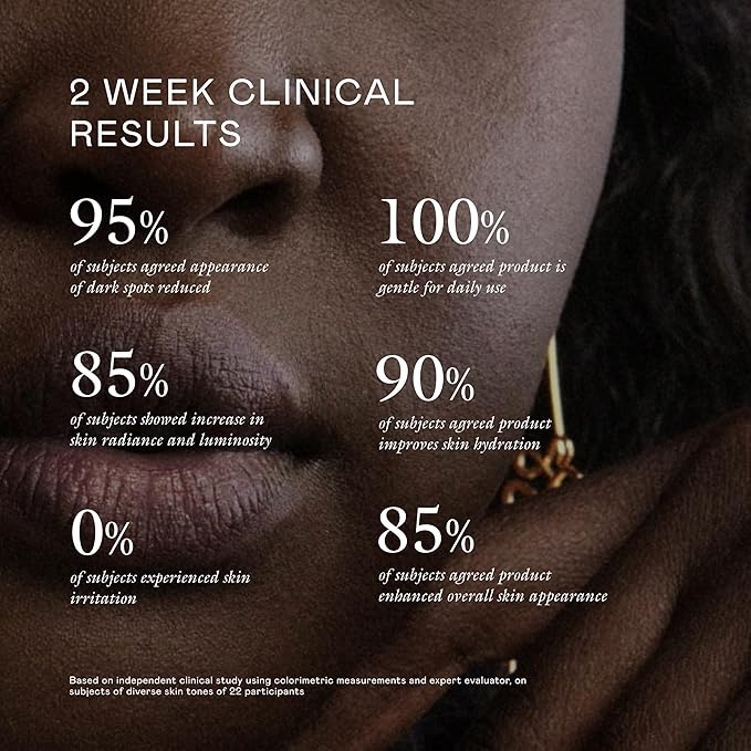 EADEM Milk Marvel Dark Spot Serum, Vitamin C Face Serum Infused with Niacinamide, Dark Spot Remover for Face & Body, Dark Spot Corrector for Skin Care, 1 oz