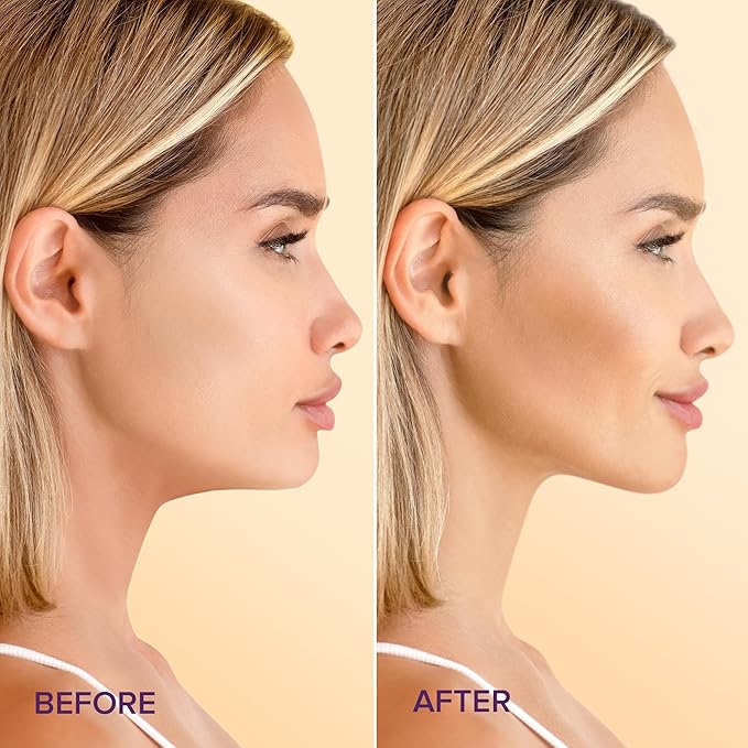 MAREE V Line Lifting Mask with 24K Gold – Deep Collagen Face Mask for Women – Jawline Shaper with Retinol & Hyaluronic Acid – Double Chin & Neck Tightening Mask for Face Lift – 5 PACK