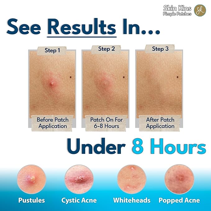 Hydrocolloid Pimple Patches for Face - Ultra-Thin 0.37mm Acne Patch with Centella - Beveled for Stronger Grip - Korean Skin Care Spot Covers - Gunk Out in 6-8 Hrs - Vegan, Made in Korea, 48 Dots