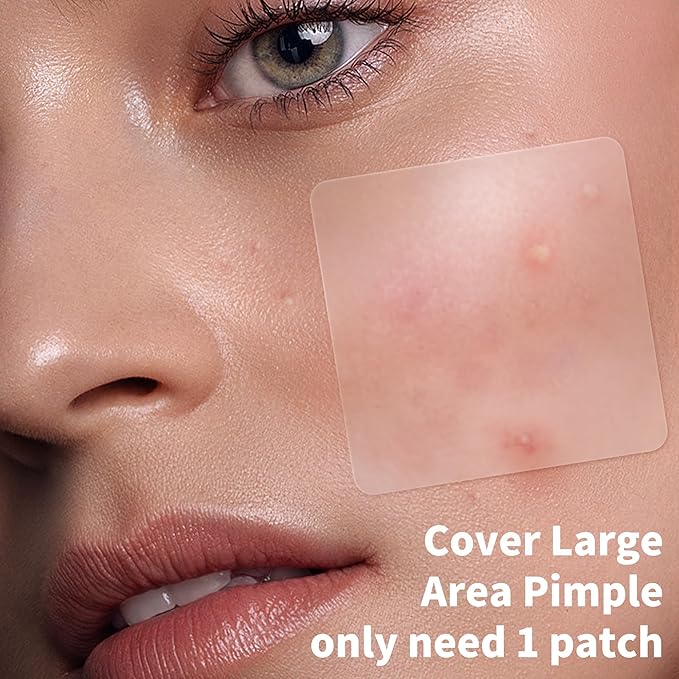 Large Pimple Patches for Face, 8 Sizes 400 Counts XL Acne Patches, Big Hydrocolloid Bandages for Body, Chin, Forehead, Chest, Back Zit Breakouts (Strip, Square, Round, Moon)