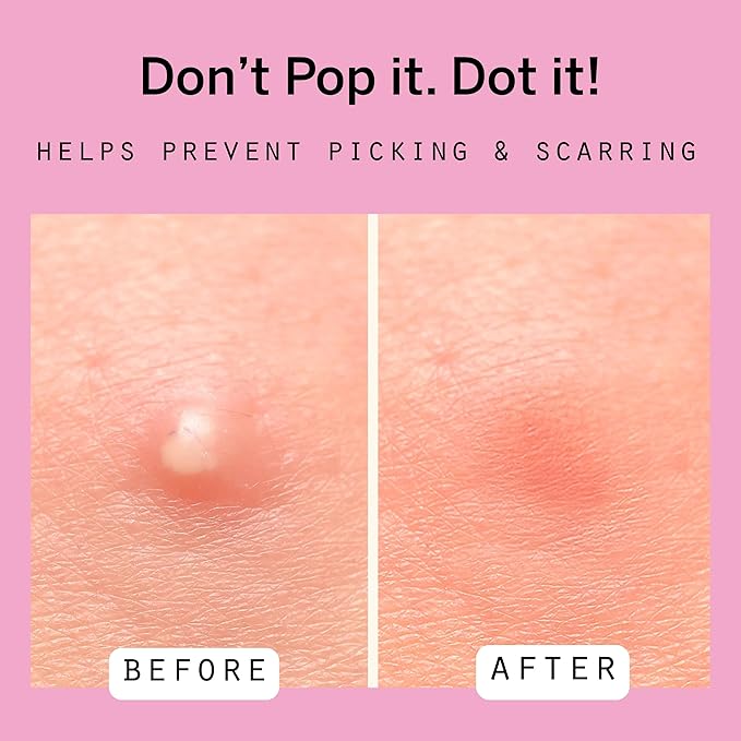 Dot Pimple Zit Patches for Face – Dermatologist Recommended & Ranked 1 for Most Effective Blemish Support – All Natural Hydrocolloid Acne Stickers with Vitamin C & Salicylic Acid (8 & 12 mm, 36 ct)