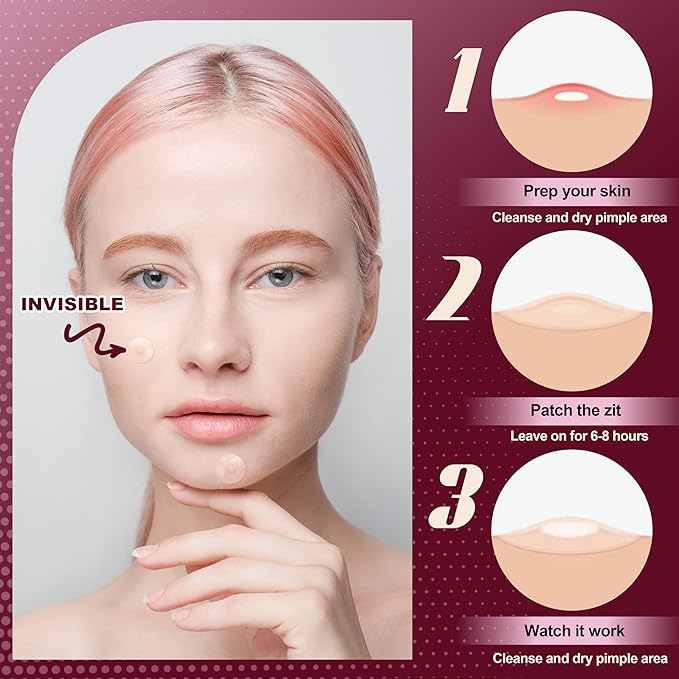 Pimple Patches for Face (300 Counts), Hydrocolloid Acne Patches for Face, Covering Blemishes, Invisible Pimple Patches, Round Shape Zit Covers, Not Tested on Animals, 4 Sizes