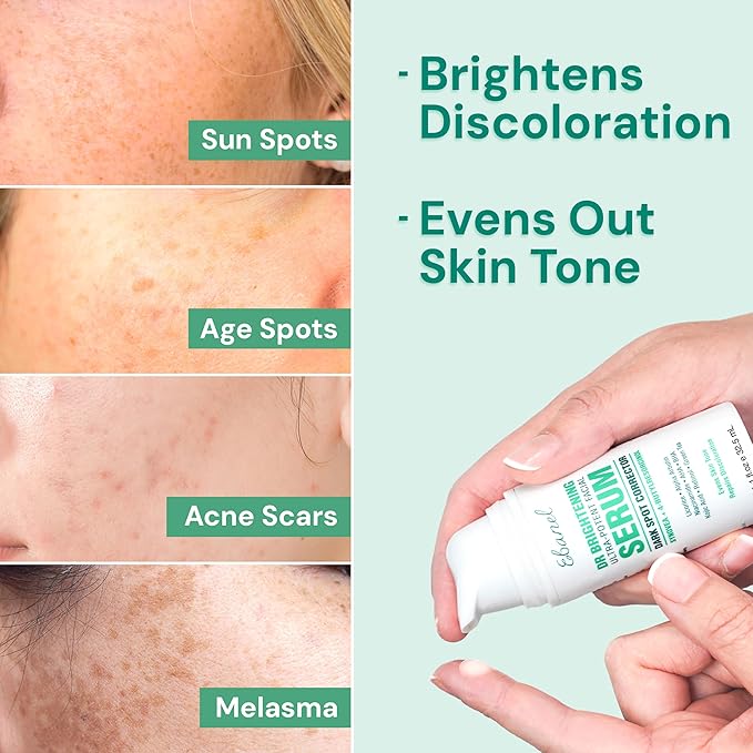 Ebanel Dark Spot Remover for Face Peel Skin Brightening Serum, Targets Melasma Hyperpigmentation Discoloration, Sun Spot Age Spots Remover, with Synovea HR, 4-Butylresorcinol, Niacinamide, Kojic Acid