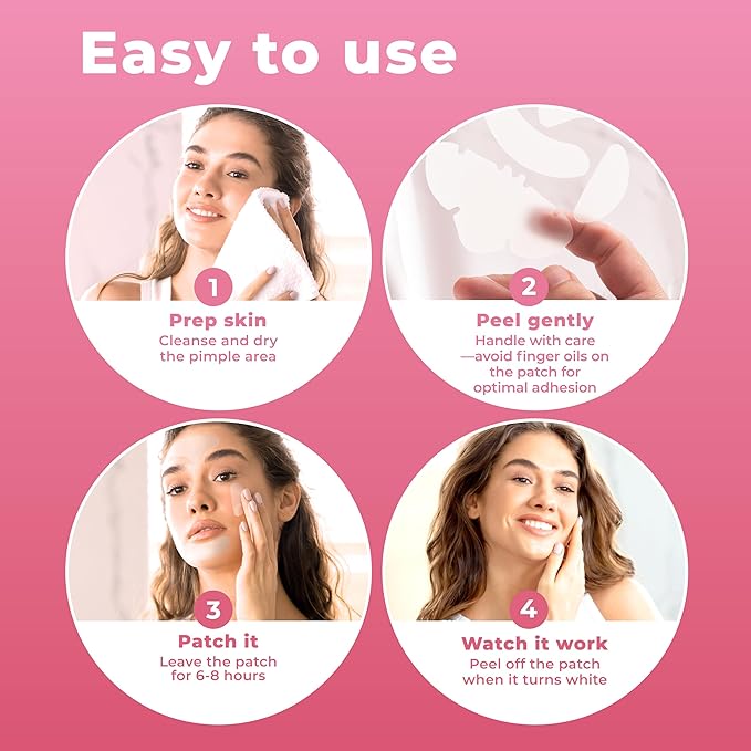 Full Face Pimple Patches (5 Sets), Reduce Pimples On Whole Face Overnight, Hydrocolloid Acne Mask, Pimple Patches, Large Acne Patches, Full Face Hydrocolloid Mask