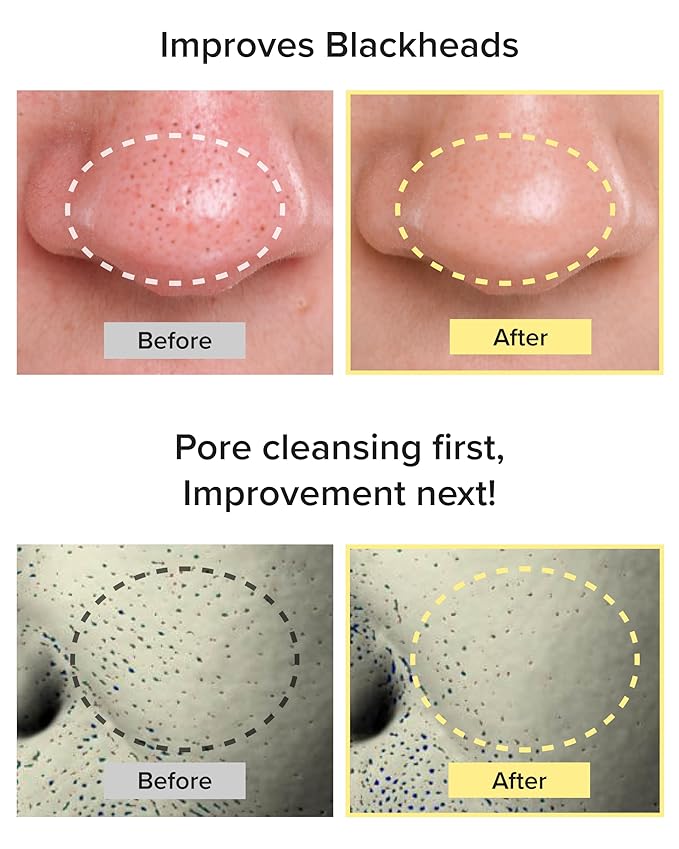 3W8L Deep Off & Fresh Cleansing Oil, Sunscreen remover, Oil Cleanser for Face, Jojoba oil, Deep cleansing, Make up blackhead pore remover, korean skin care, zero irritation on eyes