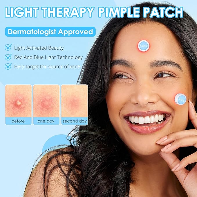AUSLKA Light Therapy Pimple Patch, LED Red and Blue Light Hydrocolloid Zit Patches, Spot Dots for Blemishe, 6-Packs, Use 6-8 hours (Blue, Eliminate Pimple Patch)