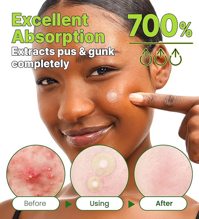 Troubless Invisible Plus Spot Patch The Red Correct - Thin Hydrocolloid w/ 98% Tea Tree Extract for Redness - High-Absorption, Seamless Adhesion & Easy-Wear Zit Patches for Face (96 ea)