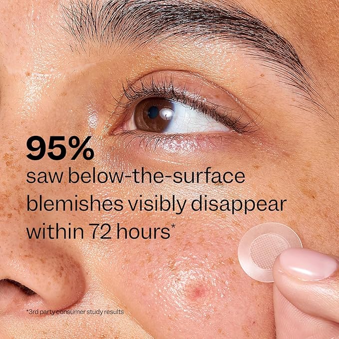 Peach Slices | Deep Blemish Microdarts | Acne Patch | Early Stage & Deep Pimples | Salicylic Acid | Tea Tree Oil | Niacinamide | Cica | Hyaluronic Acid | 9 Patches