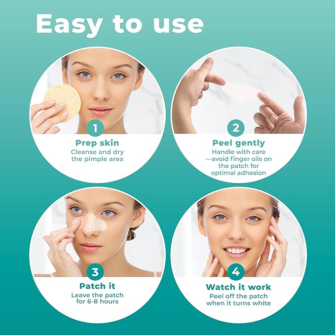 Pimple Patches for Nose (12 Pack), Cover Nose Pimples Overnight - Hydrocolloid Acne Patches - Pimple Patch Hydrocolloid Patches & Pimple Stickers, Nose Strip, Zit Patches