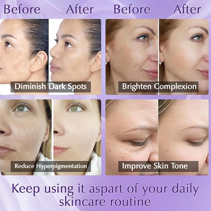 Dark Spot Remover for Face, Dark Spot Corrector Cream, Rapid Tone Repair Upgraded Formula Retinol Serum for Sun Spots, Age Spots, Skin Brown, Melasma Skin Care with Vitamin C for Women 1.7 Fl OZ