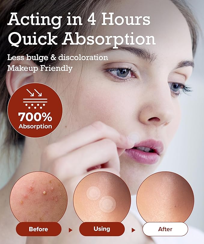 Zit Patches for Face - Invisible Spot Clear Pimple Patches - Fast Acting Thin Hydrocolloid Acne Dots Breakouts Treatment - Stickers Blemish Cover for Makeup Tea Tree, CICA, Madecassoside Waterproof