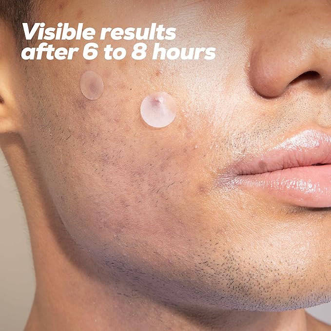 Hanhoo Men’s Blemish Patch, 36 Count, with Tea Tree, Aloe, and Bamboo, Acne Spot Treatment, Soothes Skin, Invisible Pimple Patches, Korean Skincare