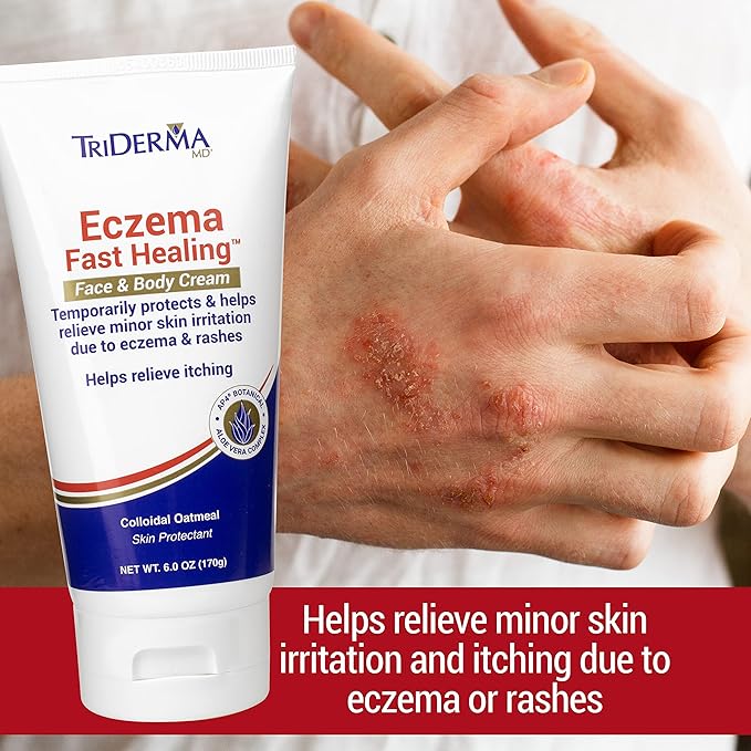 TriDerma Eczema Cream Fast Healing Eczema Relief for Face and Body, 6.0 Ounce Tube
