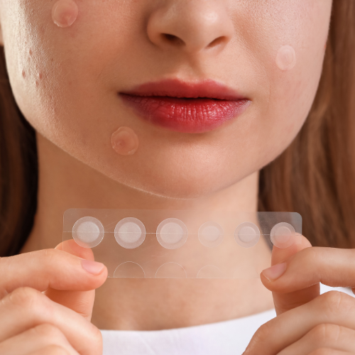 Serenity Skin acne spot patches for fast blemish and pimple care