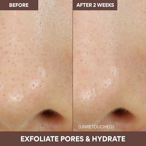 innisfree Volcanic Swirl Pore Clay Mask, 2-in-1 Korean Skincare for Exfoliating & Hydrating, For Oily & Dry Skin