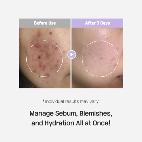 SLLIGHT Azulene Spot Control Quota Facial Pad (14 Pads, 1 Box) | Calming & Soothing Facial Pads for Sensitive Skin | Reduces Redness & Blemishes | Korean Skincare