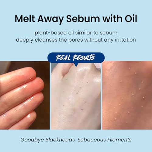 coxir ULTRA HYALURONIC ACID CLEANSING OIL 5.07 fl.oz + 0.67 fl.oz l Oil Cleanser, Hyaluronic Acid, Collagen, Hydrating, Smoothing, Calming, Moisturizing, Korean Skin Care