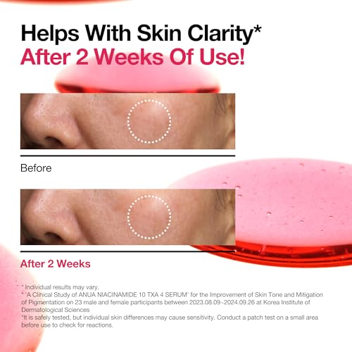 Anua Niacinamide Dark Spot Prep & Boost Duo, Mini Sheet Face for Skin Clarity, Tranexamic acid,Hyaluronic Acid for glass skin, Glow radiance synergy, Day & Night Routine, Korean skincare set