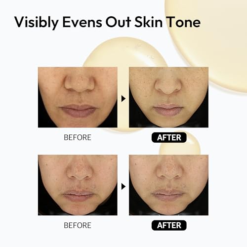 Dark Spot Correcting Serum for Face Korean Skin Care, Layerlab 10% Vitamin C Resveratrol Vitamin E Radiance Smoothing Dull Skin Tone Anti-Aging. Daily Pure Vitamin C 10% Serum 28ml 0.94 fl oz