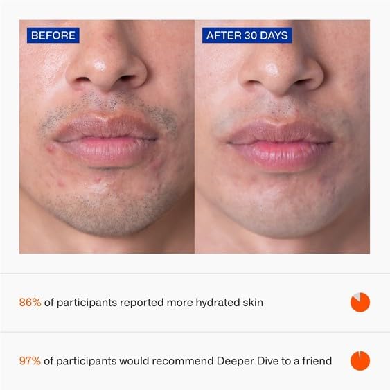 Freaks of Nature Deeper Dive Moisturizer Serum | 100% Natural Hydrating & Firming Formula | Non-Comedogenic, Eco-Friendly, Reef-Safe, Cruelty-Free | Suitable for All Skin Types | 1.7 oz