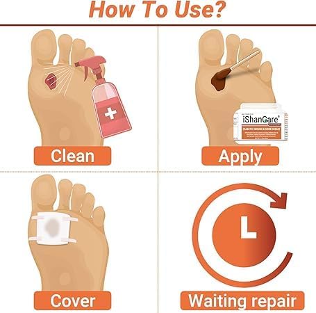 iShanCare® Diabetic Wound Ulcer Cream - First Aid Healing Ointment, Natural Protective Ointment for Leg & Foot Ulcers, Venous Ulcers, Bed Sores, Pressure Sores and Septic Wounds