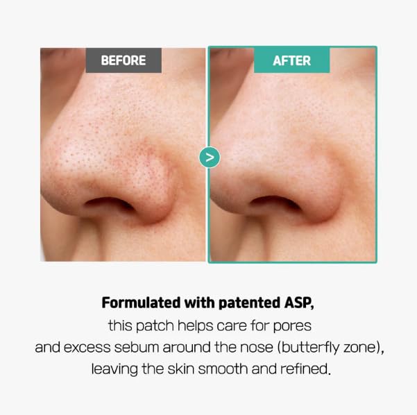 Centella Poreless Patches (1 Box, 8ea) | Hydrocolloid Nose Pore Patch for Blackhead Removal | Calming Facial Patch with Centella Asiatica for Nose Area | Sebum Control | Korean Skincare
