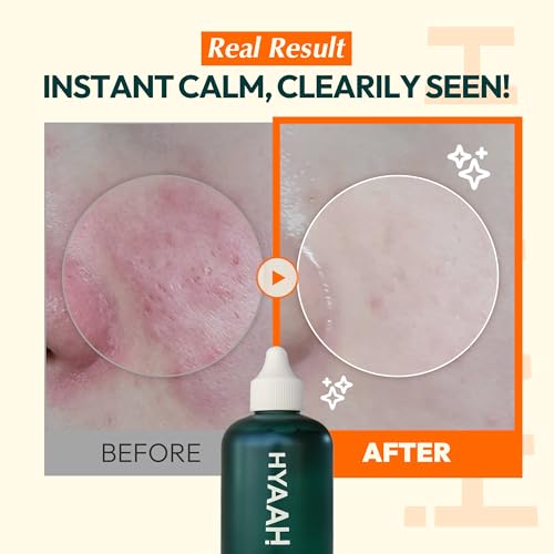 Calm & Glow Snail Mucin Serum 96 – Hydrating Facial Essence with Korean Skincare Formula for Smooth, Dewy Skin – Lightweight, Non-Sticky Texture for Daily Use