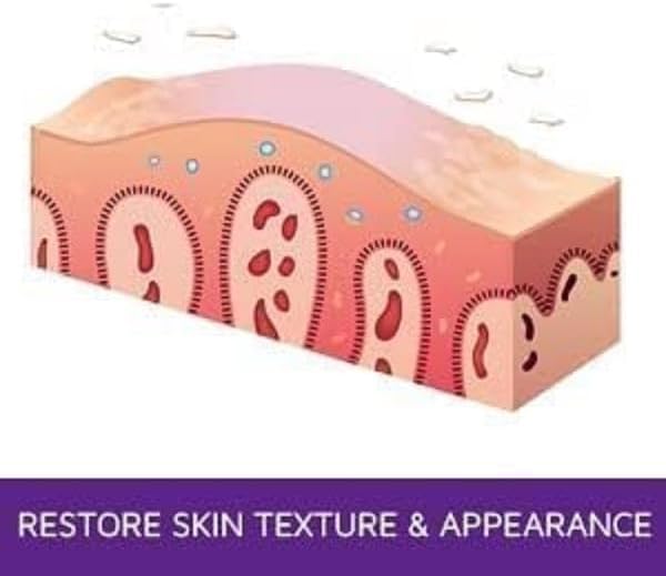 Psoriasis Exfoliating & Moisturizing Ointment – 2oz | Psoriasis Care to Restore Dry, Rough, Cracked or Scaling Skin - Shea Butter, Vitamin E, Steroid-Free | Great for Knees and Elbows