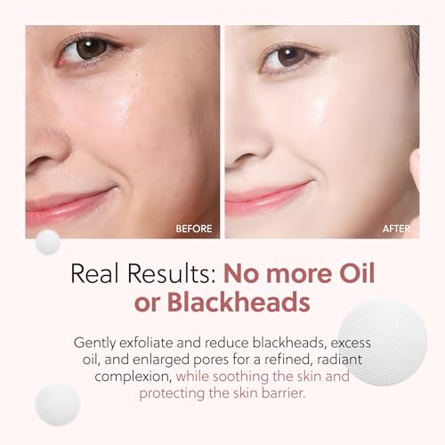 QUIA Dual-Action Toner Pads – Exfoliate and Hydrate Pores in One Step – Soothing PHA Formula for Sensitive Skin – Reduces Blackheads and Blemishes- 70 Textured Pads – Korean Skincare