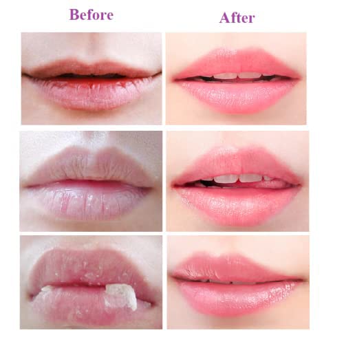 Krajiyya 2PCS Lip Balm Honey Pot,Propolis Moisturizing Honey Lip Mask Lip Balm,Hydrating & Prevention Dry and Cracked Lip Scrubs Exfoliator