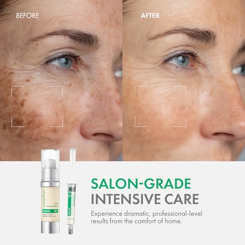 Easydew DW-EGF Melatoning Ampoule 5X - Hydrating Dark Spot Serum with Niacinamide & Glutathione for Uneven Patches - Fast Absorbing Day & Night Ampoule Korean Skin Care (Bottle 1.01 fl oz, EGF 5X)