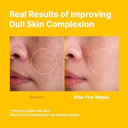 FARMSTAY Citrus Yuja Vitalizing Cream – Vitamin C Facial Moisturizer with Niacinamide for Dry & Sensitive Skin, Skin Barrier Repairing & Wrinkle Care, Korean Skincare, for Women & Men 3.52 oz.