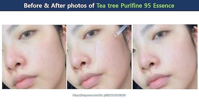 Dr.Ceuracle Tea Tree Purifine Essence - Mild Facial Serum for Sensitive Skin, Redness and Sebum Reducing Korean Skin Care (50ml / 1.69 fl. oz.)