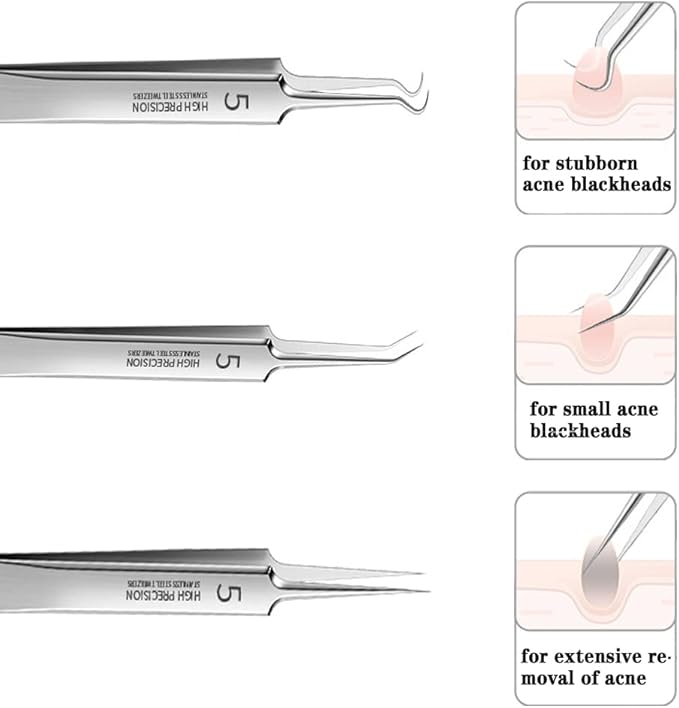 Professional Facial Blackhead Remover Tweezers,3Pcs Precision Pimple Popper Tool Kit for Whitehead Ance Blemishs Comedones Stainless Steel Makeup Tool - Glossy