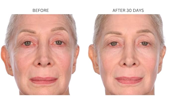 Consult Beaute XTERNA-Q Anti-Aging Universal Day and Night CoQ10 Cream - Peptide Q10 & Niacinamide Face Moisturizer for Dry Skin - Restore Skin Barrier - Visibly Reduce Lines & Wrinkles - 1 Fl Oz