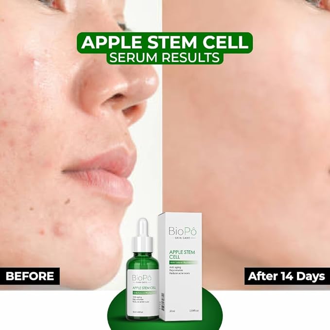 Apple Stem Cell Anti Aging Serum, Rejuvenates Skin, Reduces Acne Scars, Diminishes Fine Lines and Wrinkles, Hydrates Skin, For Radiant and Youthful Skin, 30 ml, Made in USA