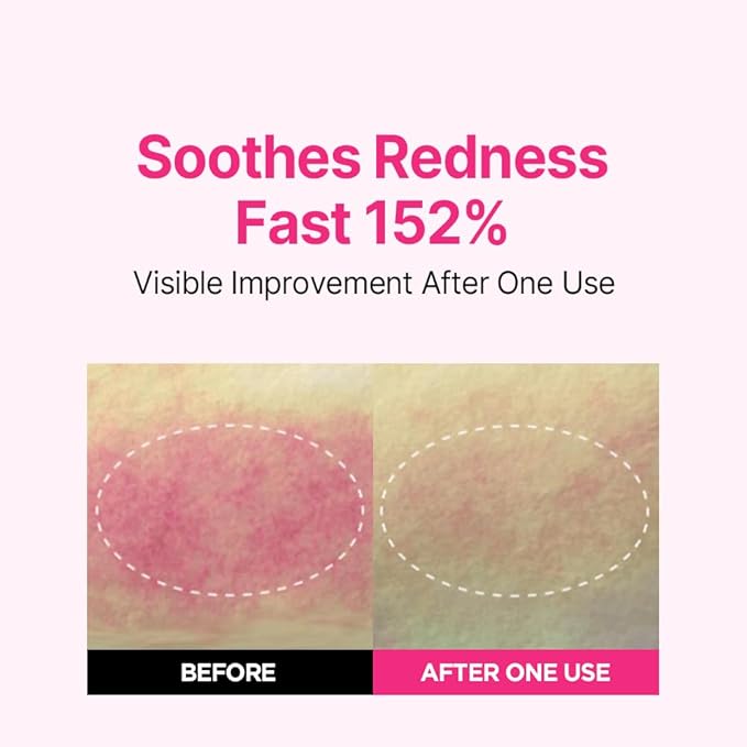 ISOI Blemish Care Up Serum for Face, Vegan Hydrating Serum for Smooth & Glass Skin Effect, Skin Barrier & Moisture Balance for Women, Korean Skin Care (1.18 fl. oz, 35ml)