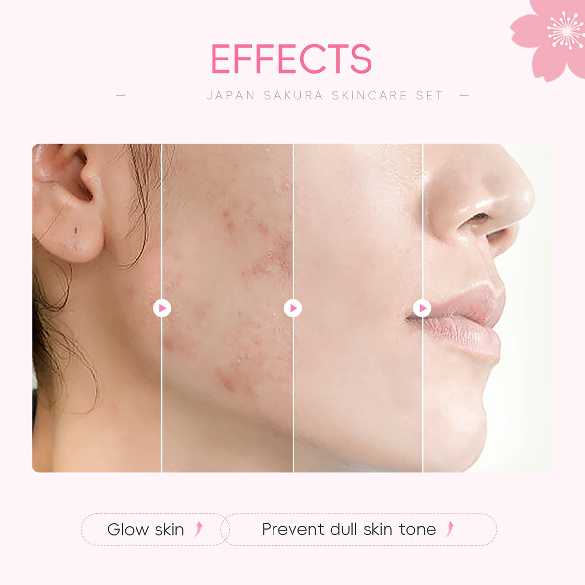 8 Pcs SakuraSkincare Set Complete Facial Care with Vitamin C, Includes Cleanser, TonerSerum, Eye Cream, Essence Cream, Sakura hairpin, Sakura hair rope, Pink octopus face wash massager